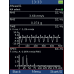 Adash 3-Channel Vibration Analyzer